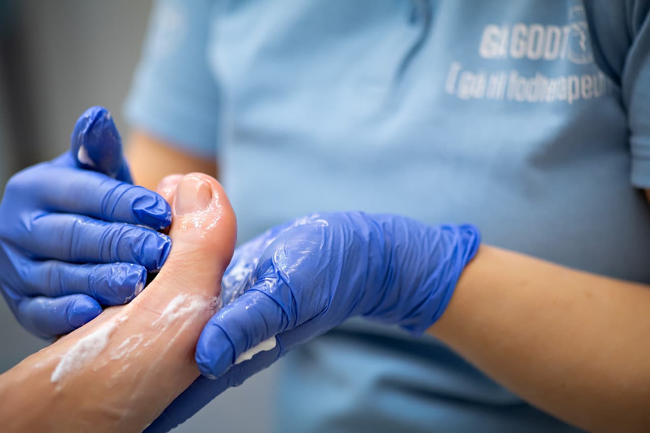 Behandling diabetes hvor fødder smøres ind i creme